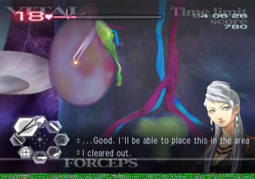 Screenshot of Trauma Center: Second Opinion gameplay.