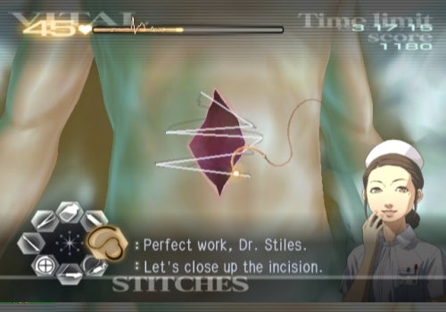 Screenshot of Trauma Center: Second Opinion gameplay.