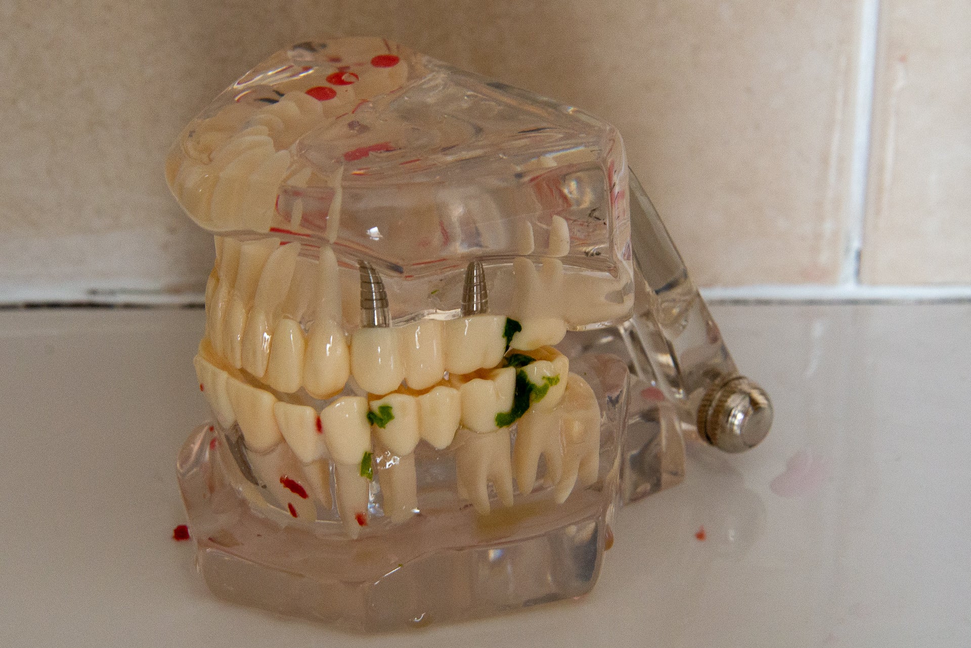 Brush-Baby KidzSonic Electric Toothbrush 3-6 years test teeth spinach