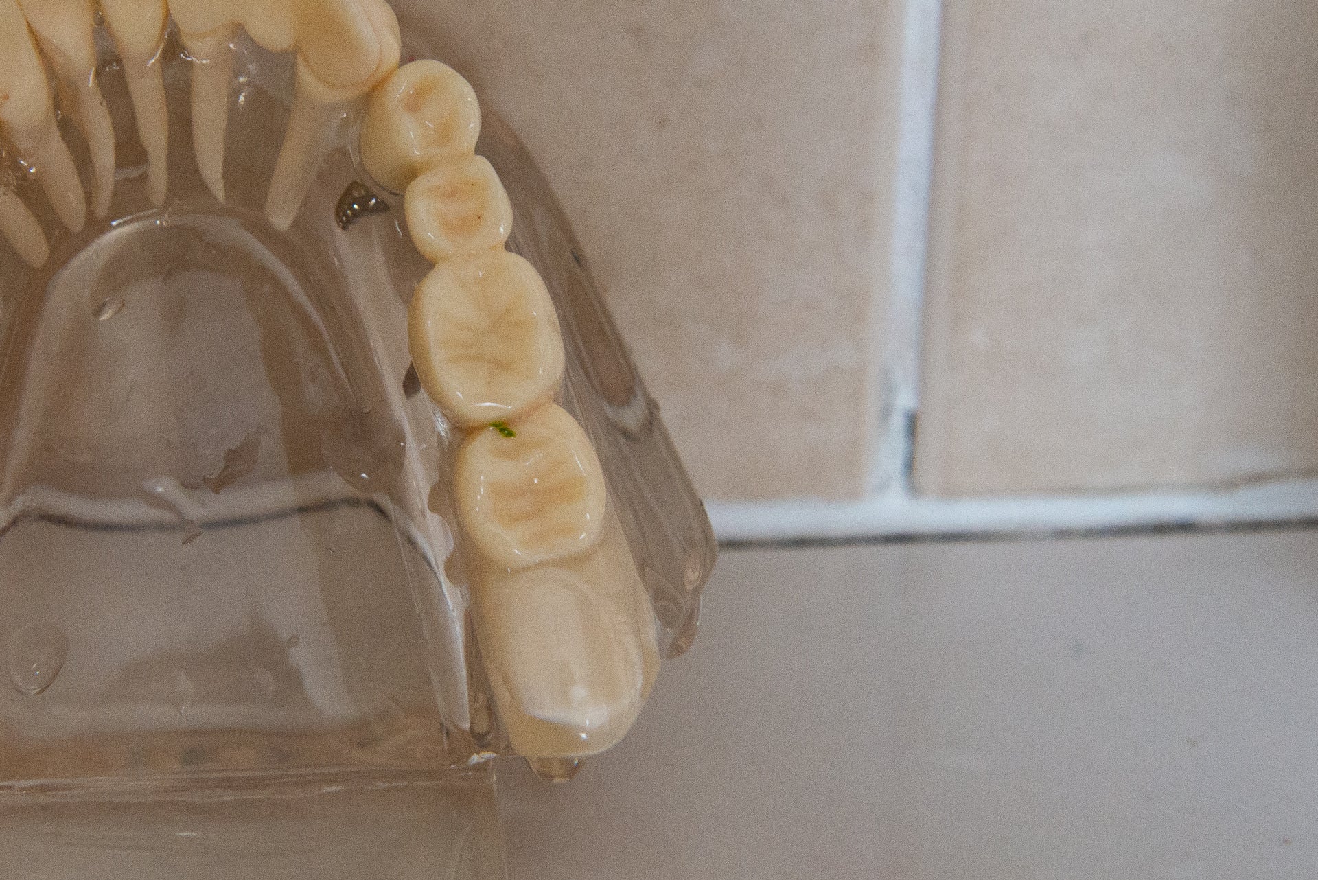 Brush-Baby KidzSonic Electric Toothbrush 6+ years teeth after clean